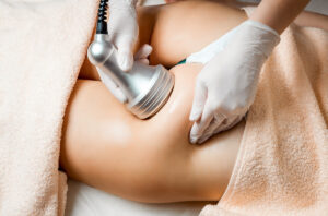 body cavitation Idyllium